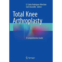 Total Knee Arthroplasty – E. Carlos Rodriguez-Merchan,Sam Oussedik