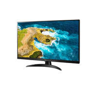 LG 28" LG 27TQ615S-PZ Smart LED TV monitor fekete
