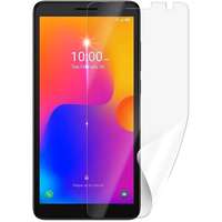 ScreenShield Screenshield ALCATEL 1B 2022 (5031G) védőfólia