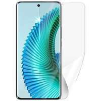 ScreenShield Screenshield HUAWEI Honor Magic 6 Lite 5G védőfólia