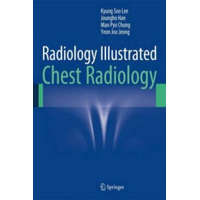  Radiology Illustrated: Chest Radiology – Kyung Soo Lee,Joungho Han,Man Pyo Chung,Yeon Joo Jeong