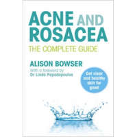 Acne and Rosacea – Alison Bowser