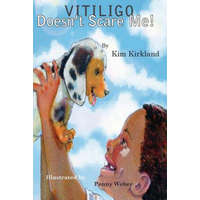  Vitiligo Doesn't Scare Me – Kim Kirkland