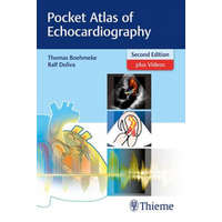  Pocket Atlas of Echocardiography – Thomas Böhmeke,Ralf Doliva