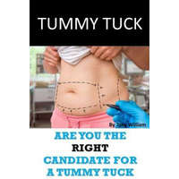 Tummy Tuck: Are You The Right Candidate For A Tummy Tuck – Tony William