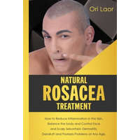 Natural Rosacea Treatment: How to Reduce Inflammation in the Skin, Balance the body and Control Face and Scalp Seborrheic Dermatitis, Dandruff an – Ori Laor