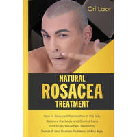 Natural Rosacea Treatment: How to Reduce Inflammation in the Skin, Balance the body and Control Face and Scalp Seborrheic Dermatitis, Dandruff an – Ori Laor