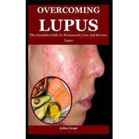  Overcoming Lupus – John Cesar