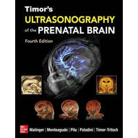 Timor's Ultrasonography of the Prenatal Brain, Fourth Edition – Ana Monteagudo,Gianluigi Pilu,Gustavo Malinger